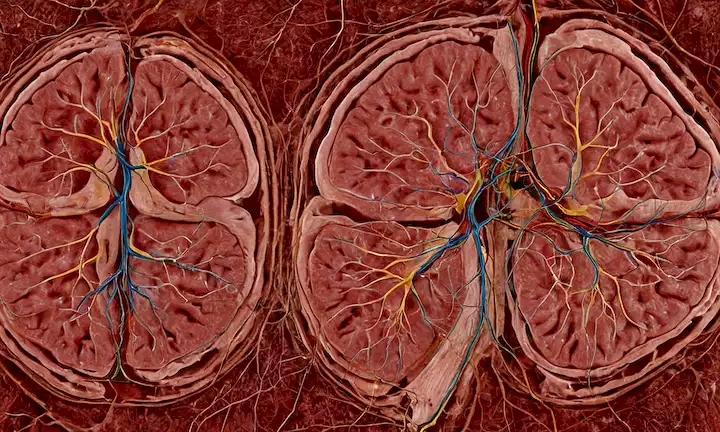 Escaneo cerebral 3D con características asimétricas, hemisferios izquierdo y derecho destacados en diferentes colores, venas y arterias visibles, conexiones neuronales tejiendo entre lóbulos, diferencias sutiles en la estructura cortical, no divisiones agudas entre partes, red intrincada de neuronas y células gliales, afeitadas para transmitir profundidad