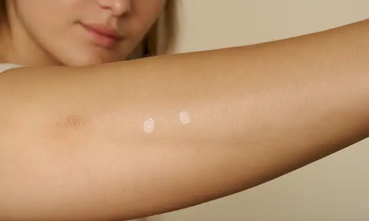 Piel con pequeños parches blancos en el brazo, disparo de acercamiento, enfoque suave, iluminación suave, colores naturales, textura sutil, ruido mínimo de fondo, atmósfera tranquila